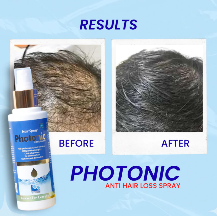 Photonic Hair Spray Anti Hair Loss - Image 2